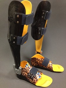 dynamische Fuß Unterschenkel  Orthese, Carbon Prepreg Technik kombiniert mit thermoplastischem Innenschaft und Neuro Swing Gelenk