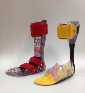 dynamische Carbon Prepreg Orthese, federnd gearbeitet und Nactlagerungsorthese aus Thermoplast