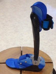 dynamische Fuß Unterschenkel  -Prepreg Carbon Orthese mit thermoplastischem Innenschaft und Neuro Swing Gelenk, kombinierte Bauweise