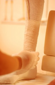 Umwickeln mit Gipsbinden, Lederband zum späteren auftrennen mit eingewickelt