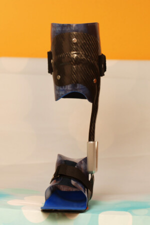 dynamische Fuß Unterschenkel  Orthese aus Carbon Prepreg mit thermoplastischem Innenschaft und Neuro Swing Gelenk, kombinierte Bauweise