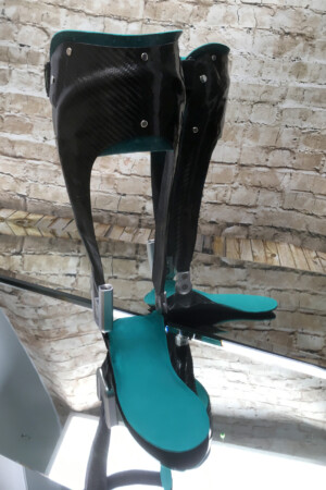 dynamische Fuß Unterschenkel Orthese Carbon Prepreg Technik mit thermoplastischem Innenschaft, Neuro Swing Gelenk und Mitläufergelemk, kombinierte Bauweise