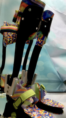 dynamische Fuß Unterschenkel  Orthese, Carbon Prepreg Technik kombiniert mit thermoplastischem Innenschaft und Neuro Swing Gelenk